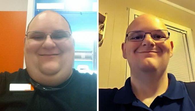 Nometis svaru cilvēks kļūst... Autors: chikooorita Neticami piemēri tam, kā cilvēku sejas mainās pēc svara zaudēšanas