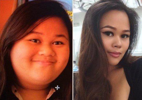 Mīnus 30 kilogrami bet kāds... Autors: chikooorita Neticami piemēri tam, kā cilvēku sejas mainās pēc svara zaudēšanas