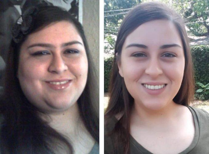 Viņai palika vieglāk 2 reizes... Autors: chikooorita Neticami piemēri tam, kā cilvēku sejas mainās pēc svara zaudēšanas