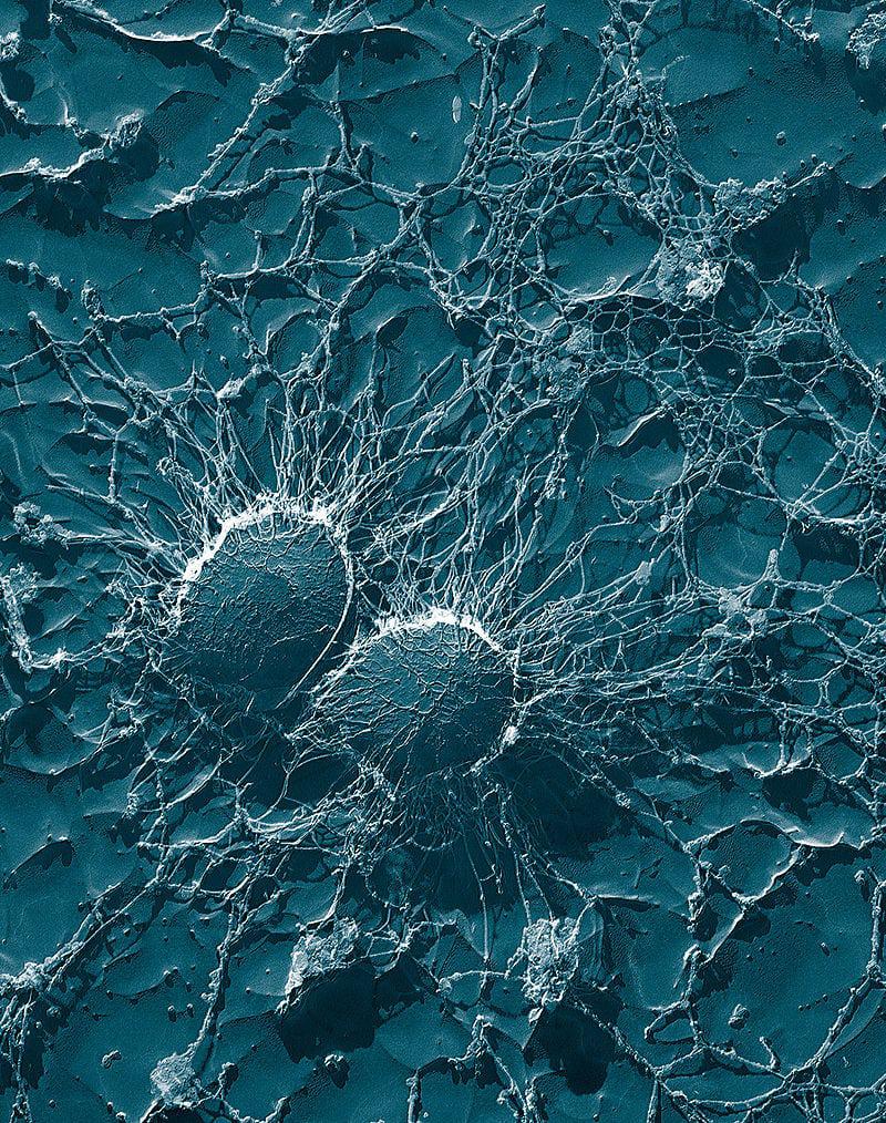 Ja netiktu radīts sintētisks... Autors: Lestets Kas notiktu, ja uz Zemes pazustu visi mikrobi?