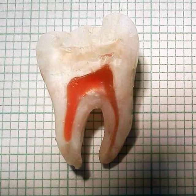 Cilvēka zobs Autors: matilde Interesanti: Lūk, kā dažādas lietas izskatās no iekšpuses