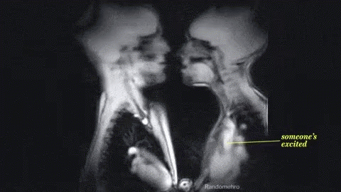 SkūpstsIlgākais reģistrētais... Autors: The Diāna 12 pārsteidzoši rentgeni, kuri liks uz pasauli raudzīties citādāk
