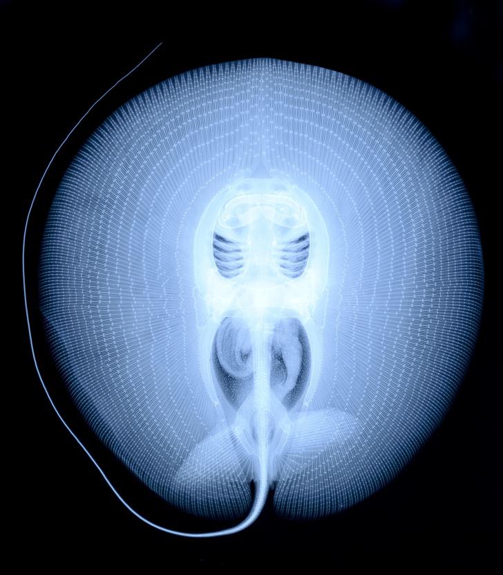 Dzeloņrajas rentgensLielākās... Autors: The Diāna 12 pārsteidzoši rentgeni, kuri liks uz pasauli raudzīties citādāk