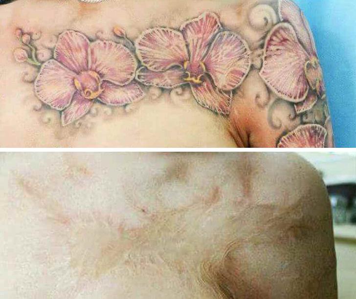 Lai kāda būtu tava āda... Autors: The Diāna 20 brīnišķīgi tetovējumi, kuri piesedz ķermeņa nepilnības un rētas