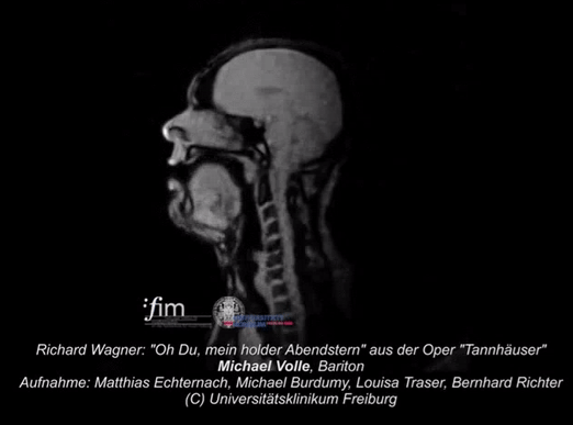 Operdziedātāja Miscaronela... Autors: Lestets 15 rentgenuzņēmumi, kas atklās par ķermeni vairāk nekā anatomijas grāmatas