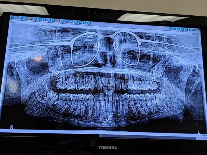 Žokļa panorāmas skats ar... Autors: Lestets 15 rentgenuzņēmumi, kas atklās par ķermeni vairāk nekā anatomijas grāmatas