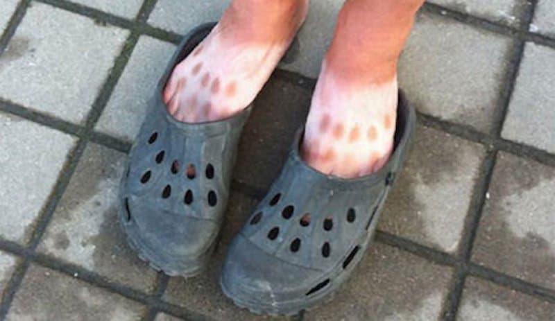  Autors: matilde 15 pierādījumi tam, ka vasarā apavi jāizvēlas ar prātu