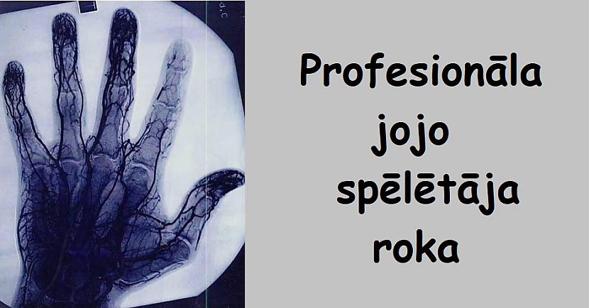 nbspProfesionāla jojo... Autors: Lestets 22 attēli, kurus tu neatradīsi nevienā enciklopēdijā