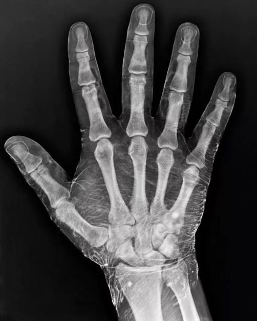Vai scaronis rentgenuzņēmums... Autors: Lestets 28 fotogrāfijas, kas ļaus mums uzzināt kaut ko jaunu