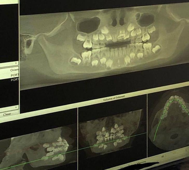 Bērna rentgenuzņēmums kas ir... Autors: Lestets 15 rentgenuzņēmumi, kas ļauj ielūkoties dzīves apslēptajās pusēs