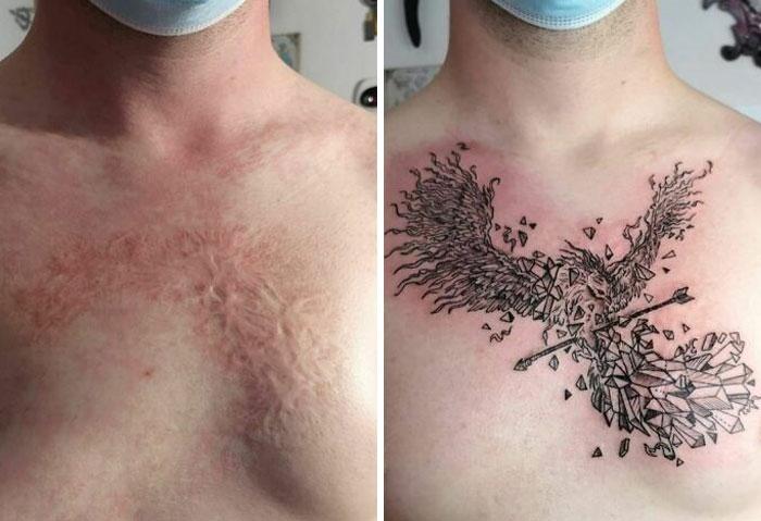  Autors: matilde 48 cilvēki, kuri izvēlējās ar tetovējumu paslēpt savas rētas vai dzimumzīmes