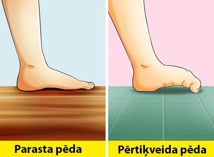 Pērtiķveida pēdaVai pēdu var... Autors: Lestets 10 ķermeņa īpatnības, kuras nav sastopamas visiem